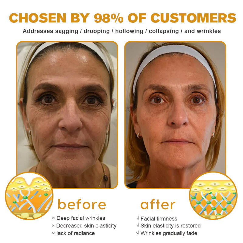 👨‍⚕️ Botox Bee Venom Wrinkle Removal Cream- LAST DAY 65% OFF✅