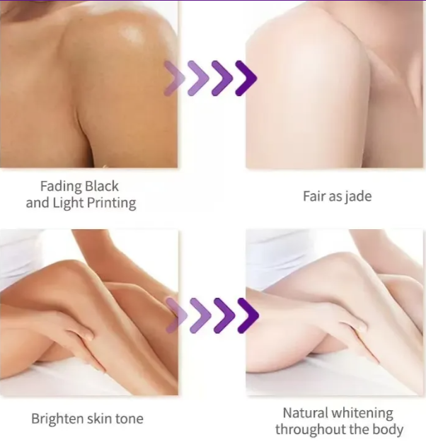 💜 LAST DAY PROMOTION - 50% OFF💜Niacinamide Rejuvenation Body Lotion