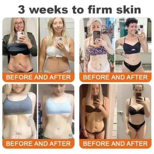 🐝🏅Flysmus™ Botox Bee Venom Firming Serum Stick-(Made and Shipped from Australia)-LAST DAY 70% OFF