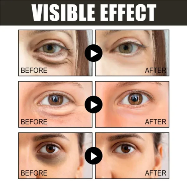 【Black Friday,50 %off】Caffeine eye cream