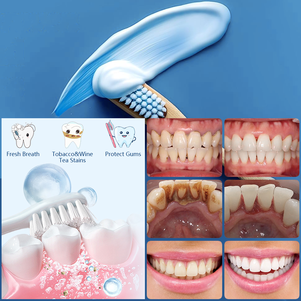 Multi-Action Fresh Mint Toothpaste for Deep Cleaning, Whitening , Cavity & Enamel Prevention, Fresh Breath