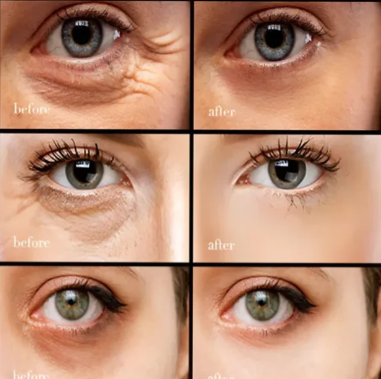 【Black Friday,50 %off】Caffeine eye cream